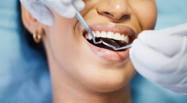 Best Emergency Treatment for Dental Infections or Abscesses in Elyria, OH